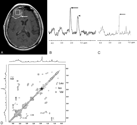 Fig 3.