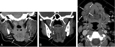 Fig 1.