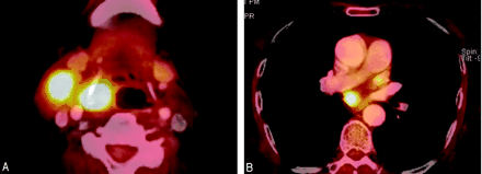 Fig 1.
