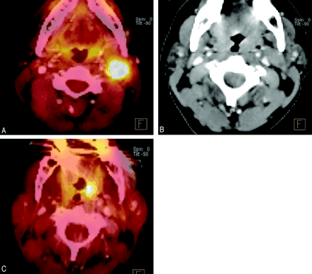 Fig 2.