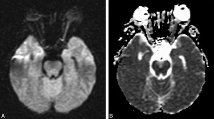   Fig 1. 