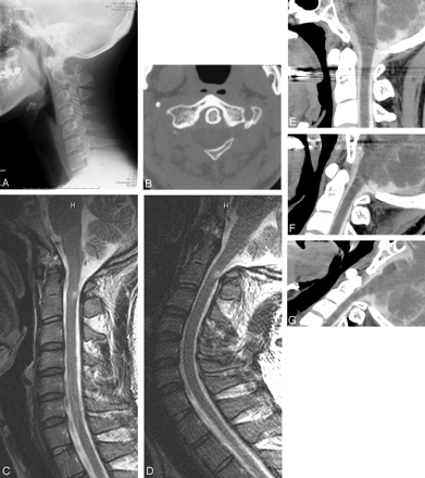   Fig 1. 