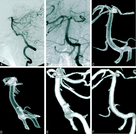Fig 3.