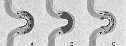 Fig 1.