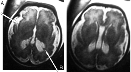 Fig 2.