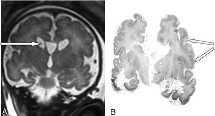 Fig 3.