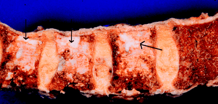 Fig 4.