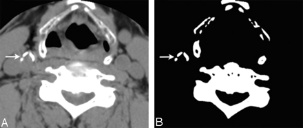 Fig 1.