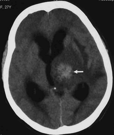 Fig 1.