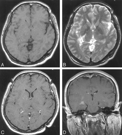 Fig 1.