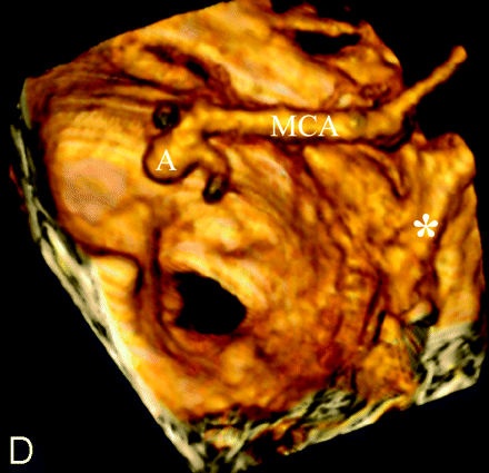 Fig 2.