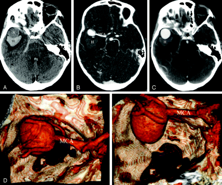 Fig 3.