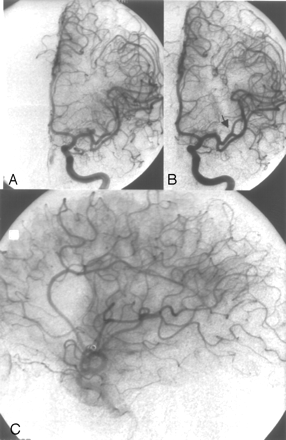 Fig 2.