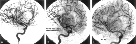 Fig 3.