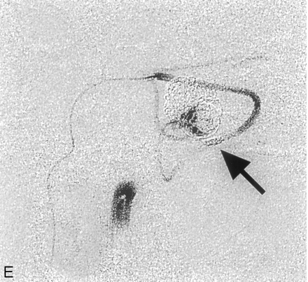 Fig 2.