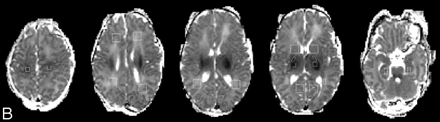 Fig 1.