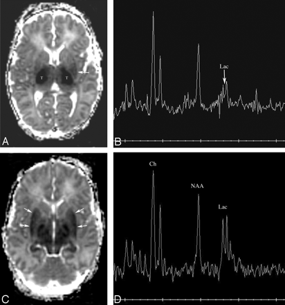 Fig 3.