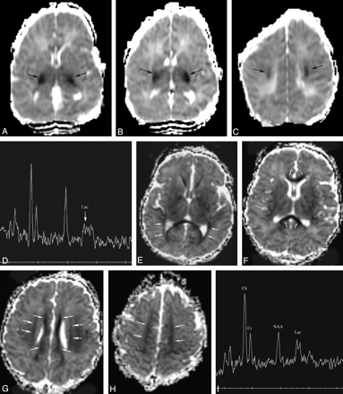 Fig 5.