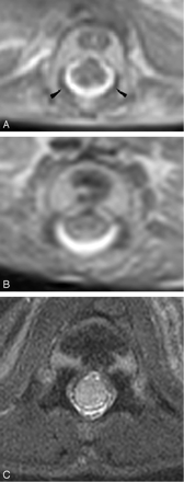 Fig 6.