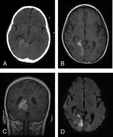 Fig 1.