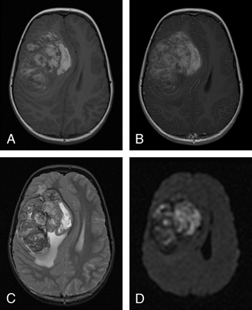 Fig 2.
