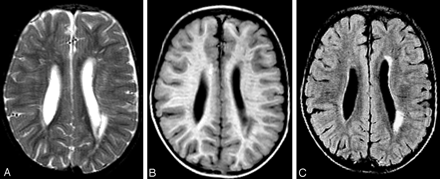 Fig 1.