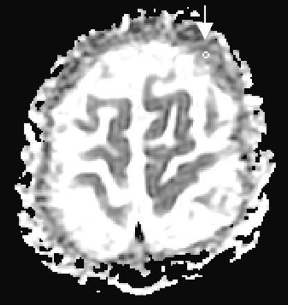 Fig 3.