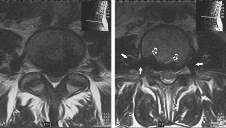Fig 1.