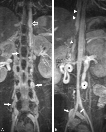 Fig 3.