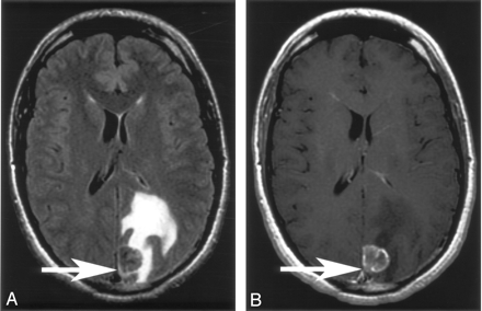 Fig 2.