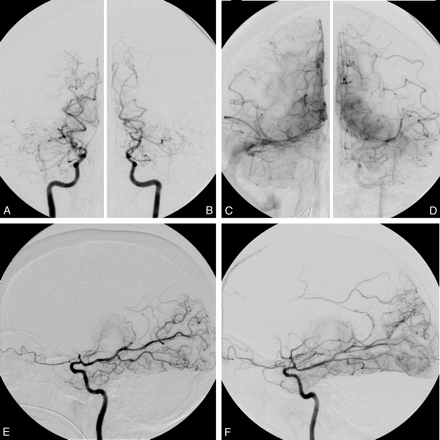 Fig 2.