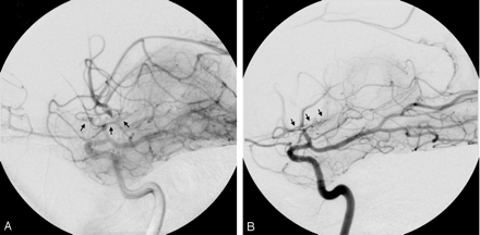 Fig 3.
