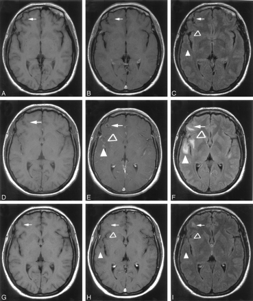 Fig 2.