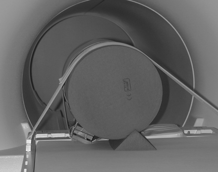 Fig 4.