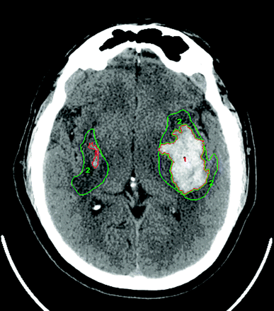 Fig 2.