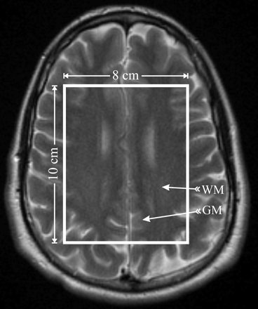 Fig 1.