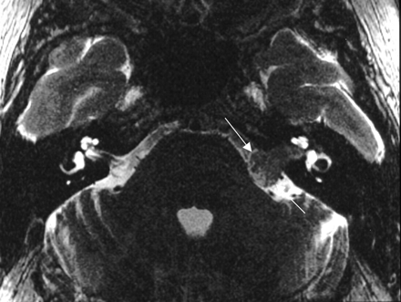 Fig 1.