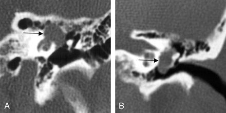 Fig 7.