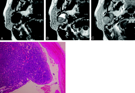 Fig 2.