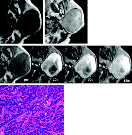 Fig 3.