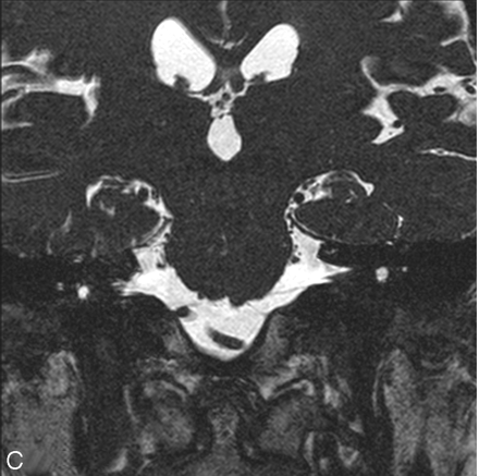 Fig 1.