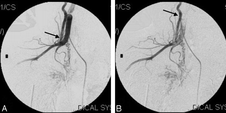 Fig 4.