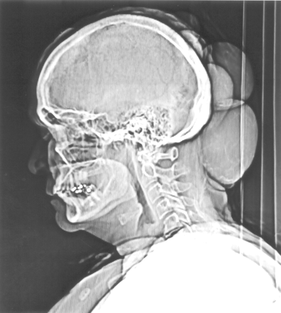 Fig 1.