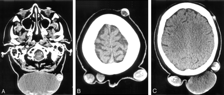 Fig 2.