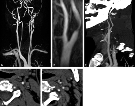 Fig 4.