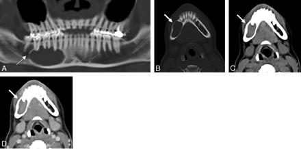Fig 1.