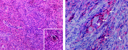 Fig 3.