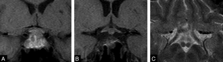 Fig 1.