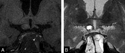 Fig 3.