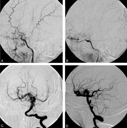 Fig 1.